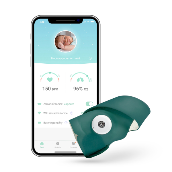 Owlet Smart Sock 3 - Smart Sock 0-18 months (Deep Sea Green)